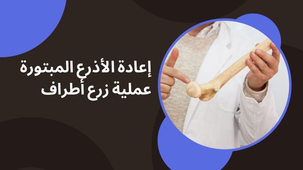 إعادة الأذرع المبتورة عملية زرع أطراف