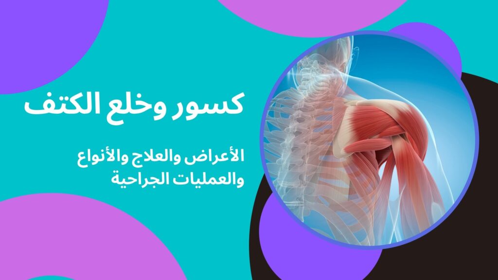 كسور وخلع الكتف - الأعراض والعلاج والأنواع والعمليات الجراحية