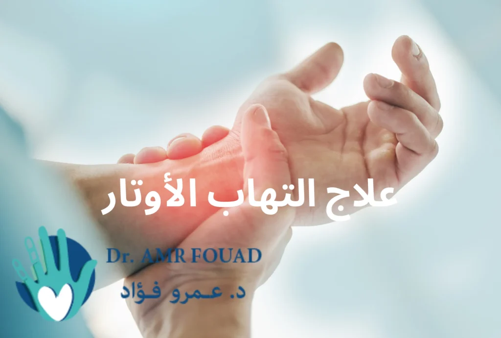 علاج التهاب الأوتار