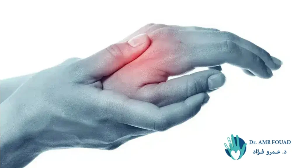 اعراض شرخ اليد 1 اعراض شرخ اليد
