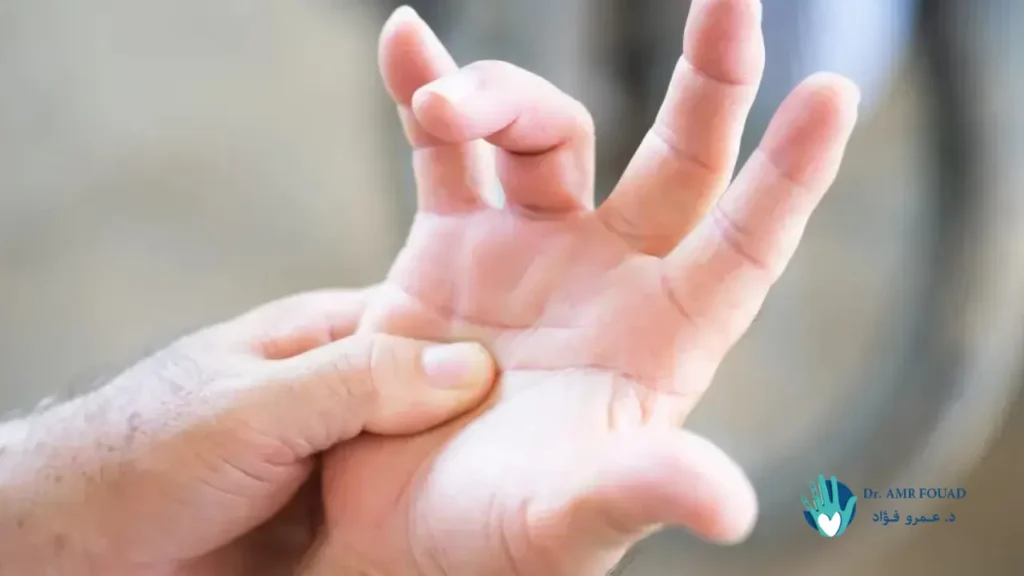 أسباب الإصبع الزنادي وعلاجه الفعال 1 أسباب الإصبع الزنادي1