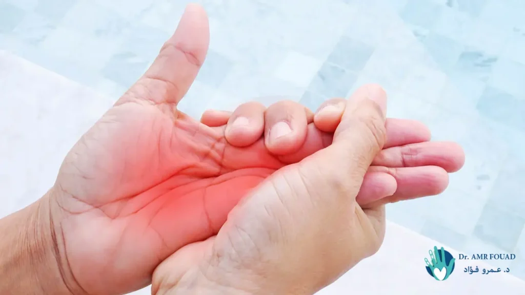 أعراض ضعف أعصاب اليد 1 أعراض ضعف أعصاب اليد