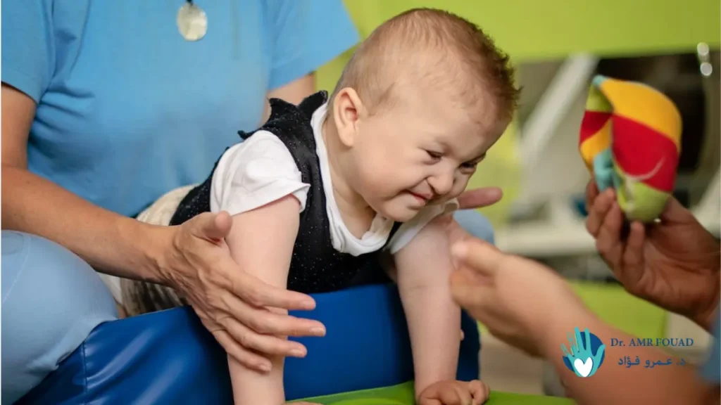 اعراض الشلل الدماغي عند الرضع 1 اعراض الشلل الدماغي عند الرضع1