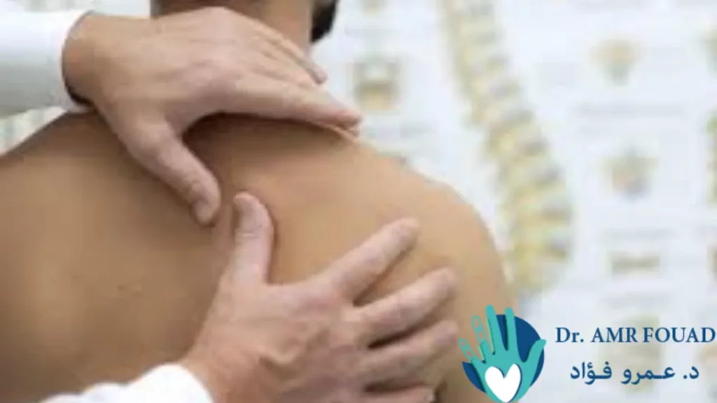 إصابة الضفيرة العضدية: الأسباب والعلاج ونسبة نجاح عملية الضفيرة العضدية 1 إصابة الضفيرة العضدية