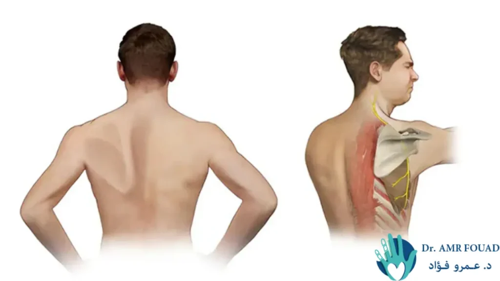 اعراض التهاب الضفيرة العصبية