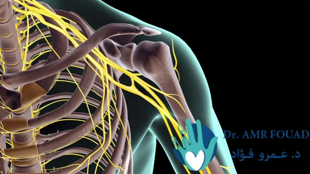 الضفيرة العصبية: دليل شامل عن الأسباب، الأعراض والعلاج  1 الضفيرة العصبية