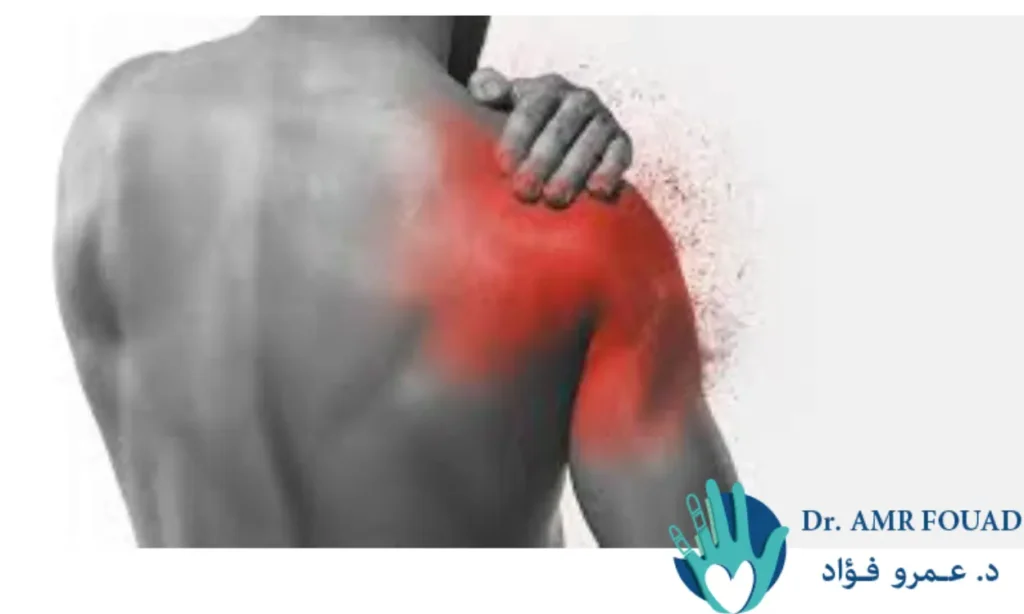 أعراض التهاب الضفيرة العصبية