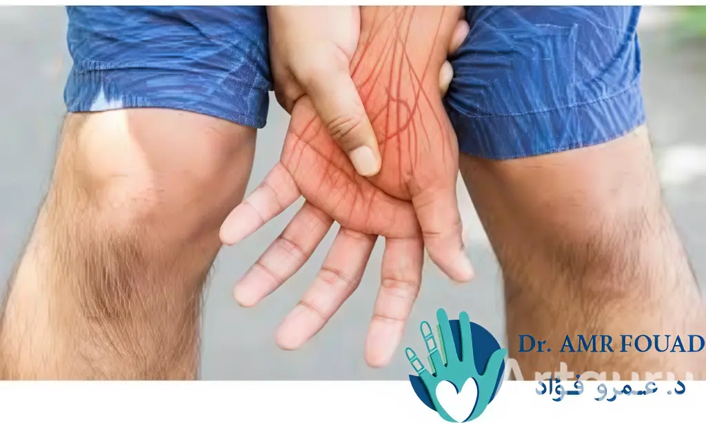 أعراض التهاب الأعصاب في اليد 1 أعراض التهاب الأعصاب في اليد