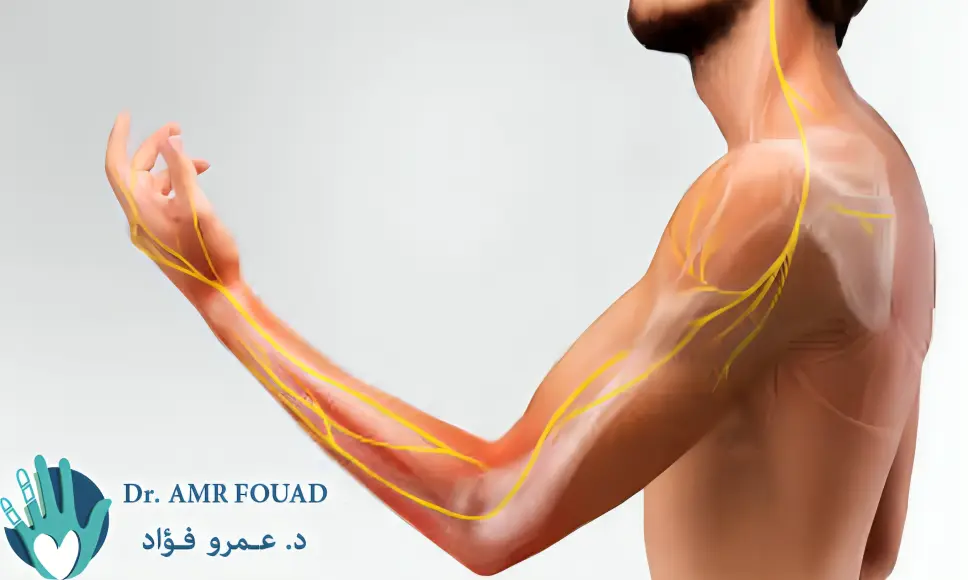 الم الذراع الاسباب , الاعراض , التشخيص و العلاج الفعال 5 الم الذراع الاسباب و العلاج