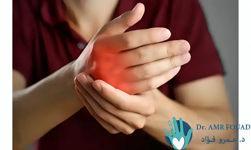 اسباب تشنج اصابع اليد و متى يكون السبب عصبي أو في الأوتار 1 اسباب تشنج اصابع اليد