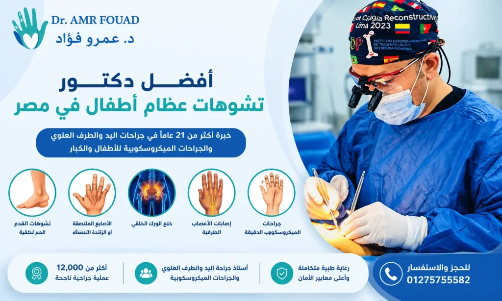 افضل دكتور تشوهات عظام اطفال فى مصر
