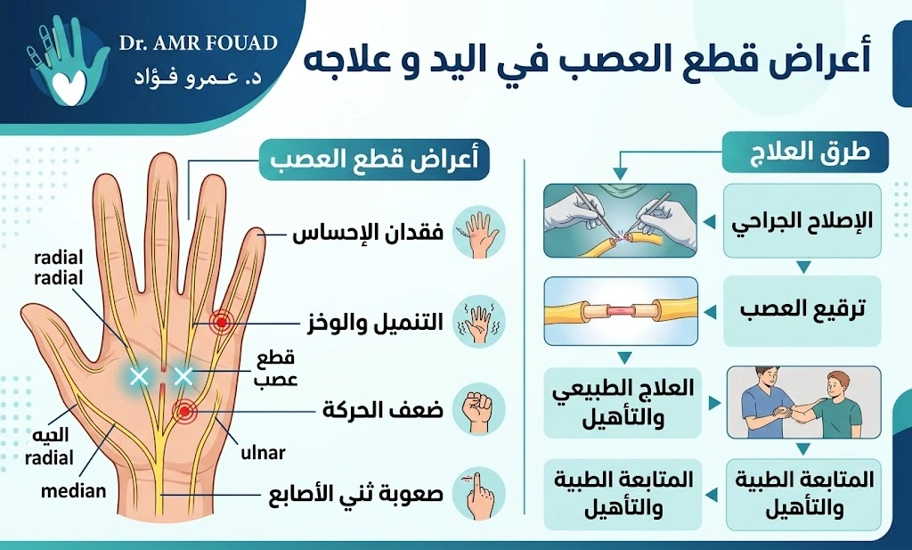 أعراض قطع العصب في اليد وعلاجه